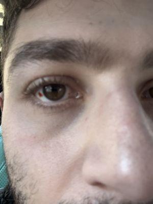 LASIK of Nevada - Las Vegas South