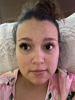 12 hours after my appointment