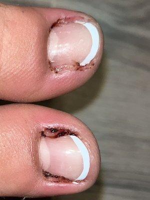 My toes the day after getting a pedicure at this place.