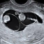 Center For Fetal Medicine & Women's Ultrasound