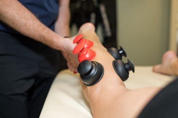 Cupping in Sports Recovery Session