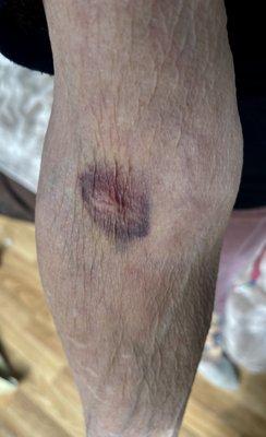 The result of my bloodwork yesterday at Quest Diagnostics in Petaluma. WTH?