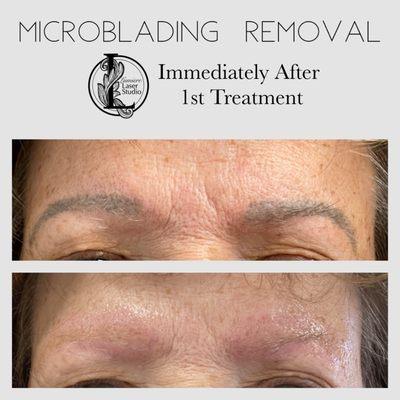 Lumiere Laser Studio