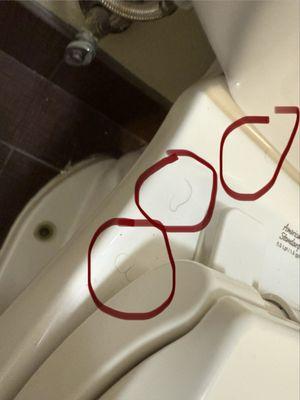 3 "Hairs" on a single section of the toilet - there were also multiple on the seat and inside and around the bathtub.