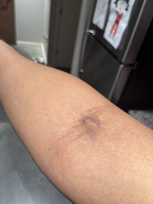 BioLife Plasma Services