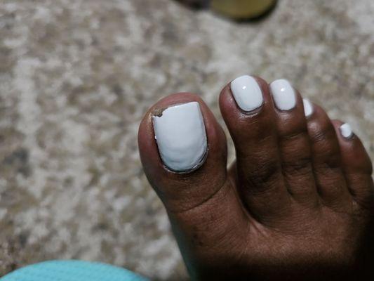 My Big toe (lumpy polish job) chipped 2 days after getting a polish change.