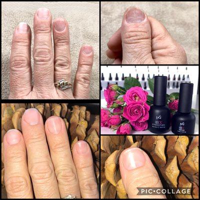 IBX Repair & Strengthening System. Top pictures are before 1st Treatment, the bottom pictures are at 5 weeks and after 4 treatments.