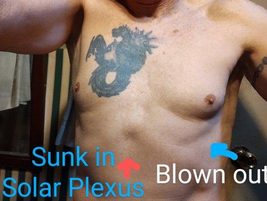 Kettering Health Breast Center