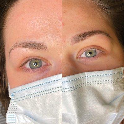 Before and After Microblading