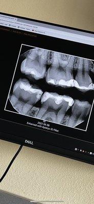 Diablo Hills Dental Excellence