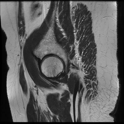 maybe someone else out there can give us a report on this