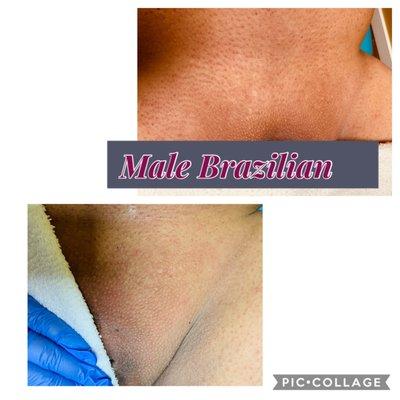 Male Brazilian ( Malezilian)