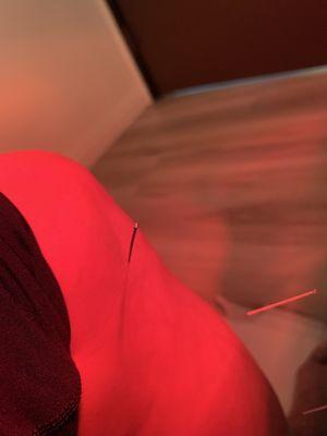 Acupuncture points for my leg.