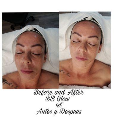 Before and after BB Glow / whitening