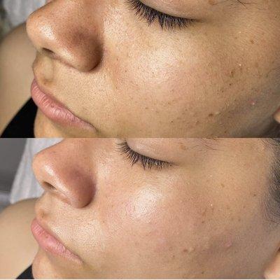 Signature gleam facial