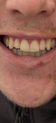 Colorado Healthy Smiles