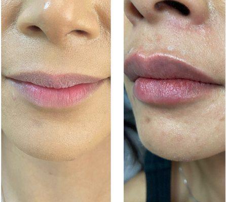 Beautique Clinic Medical Aesthetic