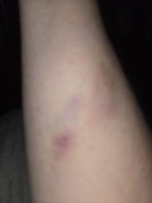 Pinnacle Health and Spa