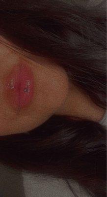 Lip piercing