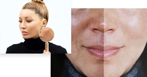 Advanced Dermatology, P.C. | Jackson Heights