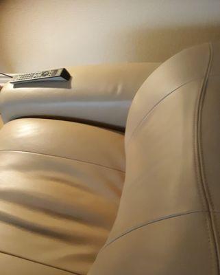 Permanent elbow hole after 2 weeks.