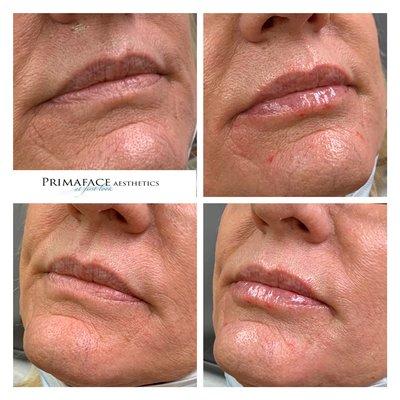 PrimaFace Aesthetics