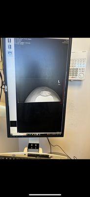 Michael Vercillo, MD