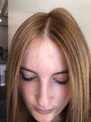 Baby lights and shadow root