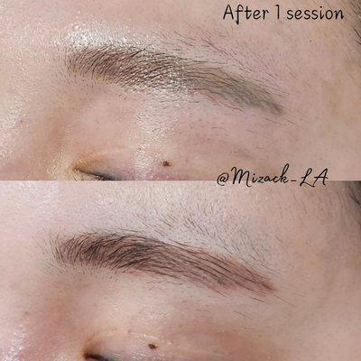Brows permanent makeup REMOVAL after 1 session