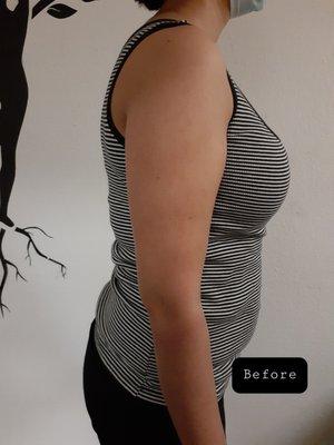 Natuever Acupuncture