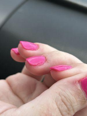 Shoddy manicure in general. Messy.