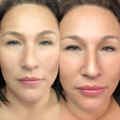 Before and After Microblading only.