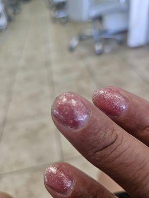 Chipped gel nail after 2 days