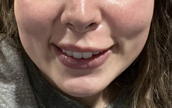 Tide Medical Weight Loss