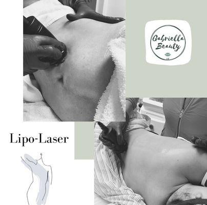 Non-invasive LipoLaser to target stubborn fat and contour your body -- no downtime!