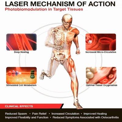 Healing properties of Class IV Laser Therapy