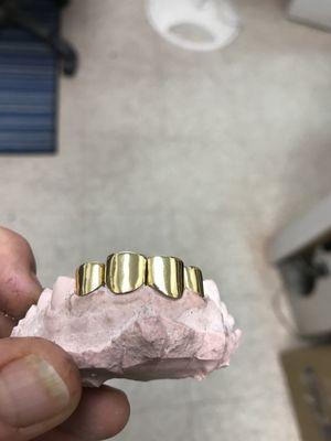 Gold teeth of Baton Rouge