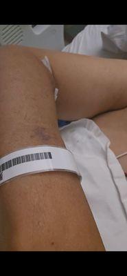 Encompass Health Rehabilitation Hospital of Toledo