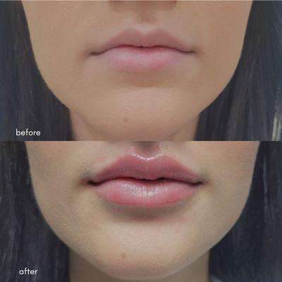 Botox and Beauty Boutiques