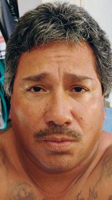 Picou Keith A Clinic