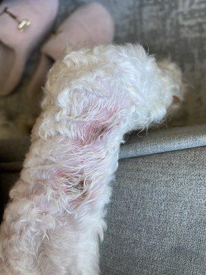 Blistering razor burn