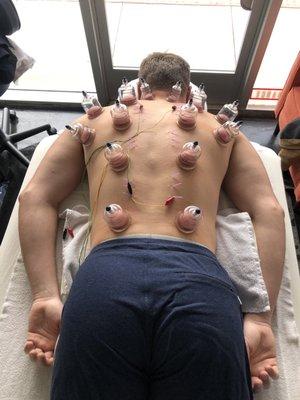 Balance Point Therapy