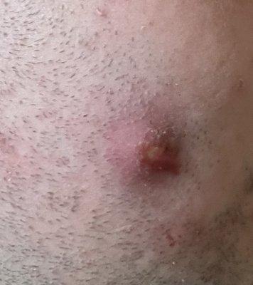 CareNow Urgent Care-Murfreesboro