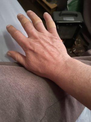 Other hand as reference