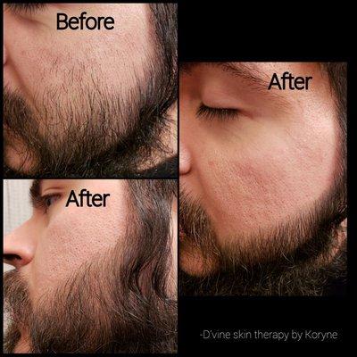 D'vine Skin Therapy by Koryne