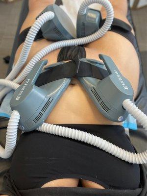 EMSlim at sculpt squad