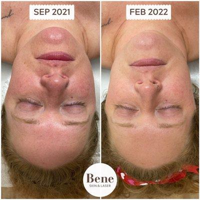 Bene Skin & Laser
