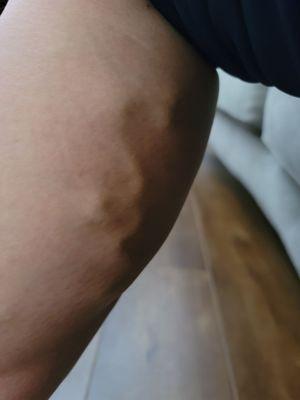 Y.H. Salem, MD, FACS