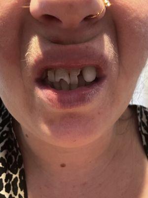 If your want your mouth looking like so, after paying 34,000$ CASH to fix!!! Than go to her!