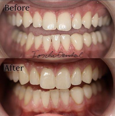 Toschi Dental: Steven M. Toschi, DDS and Jeffery Toschi, DMD